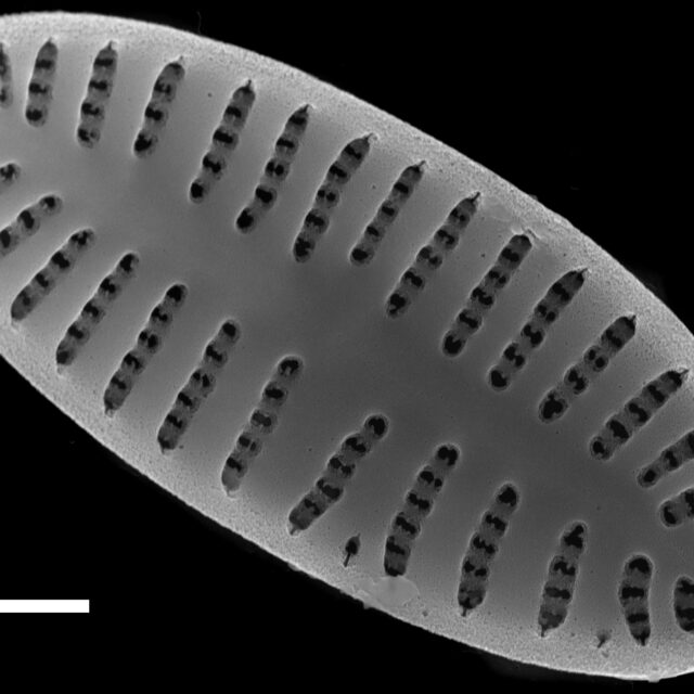 Karayevia oblongella SEM4