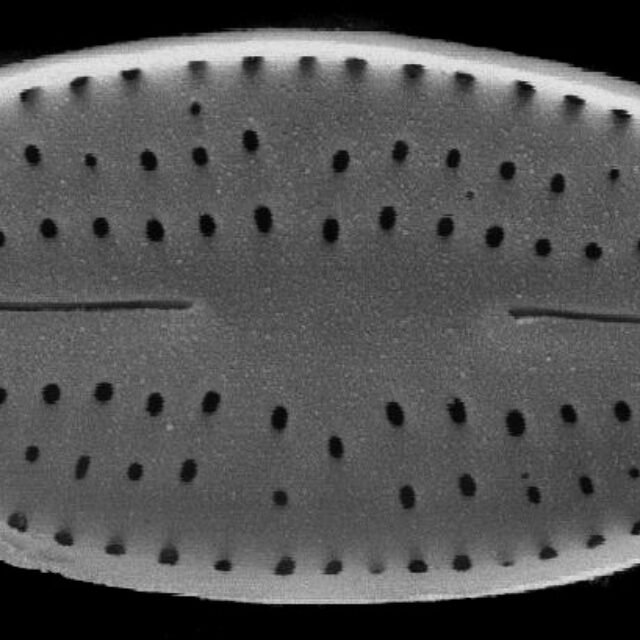 Nupela neglecta SEM1