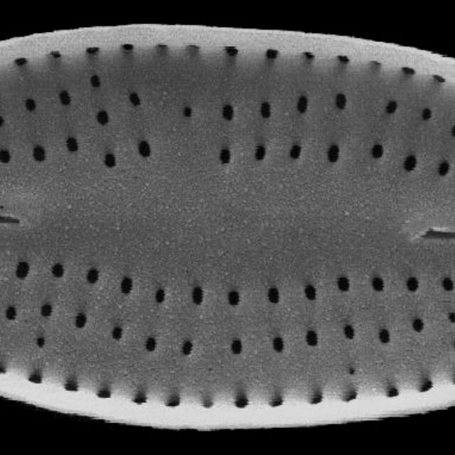 Nupela neglecta SEM2