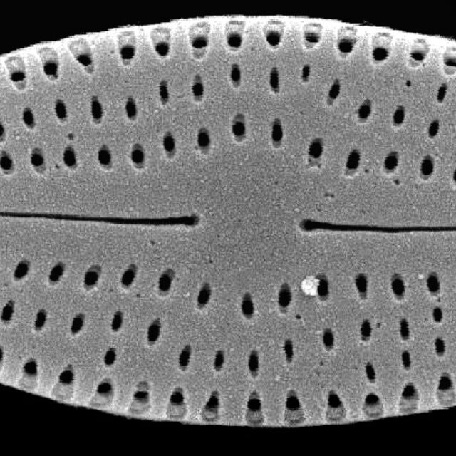 Nupela neglecta SEM3