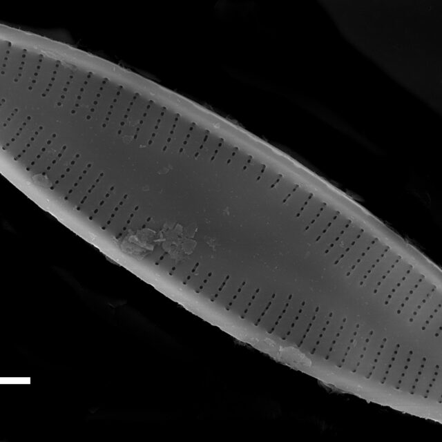 Nupela subrostrata SEM1