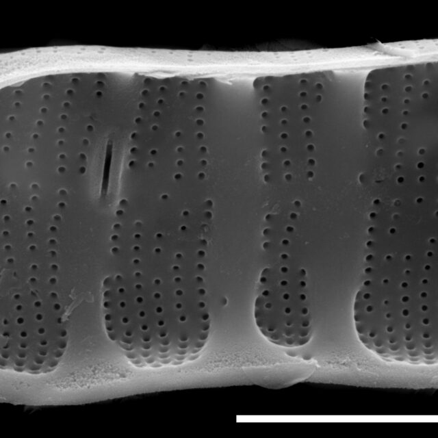 Diatoma tenuis SEM4