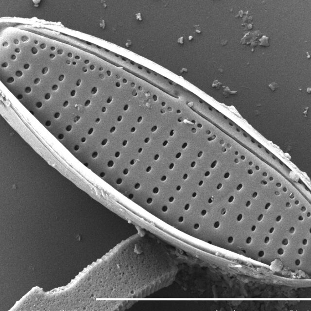 Nitzschia Soratensis Sem1