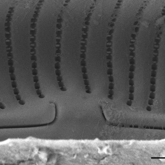 Encyonema norvegicum SEM2