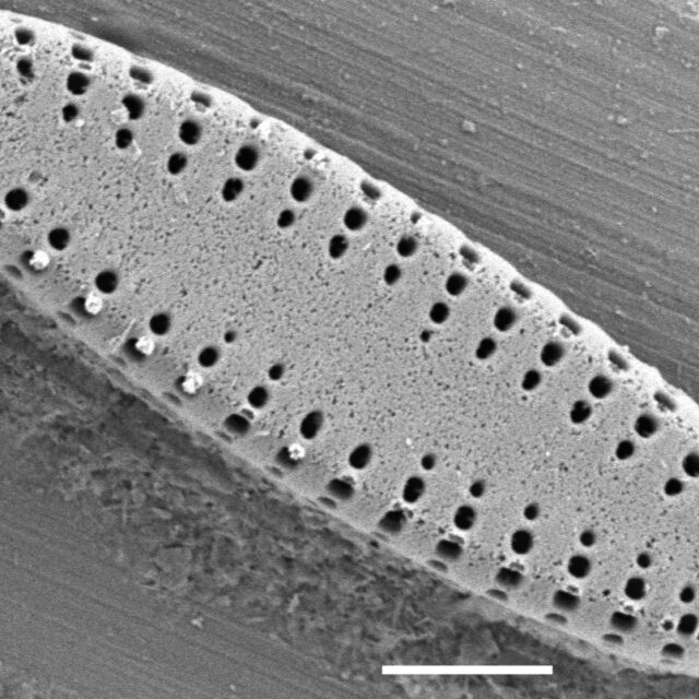 Pseudostaurosira neoelliptica SEM1