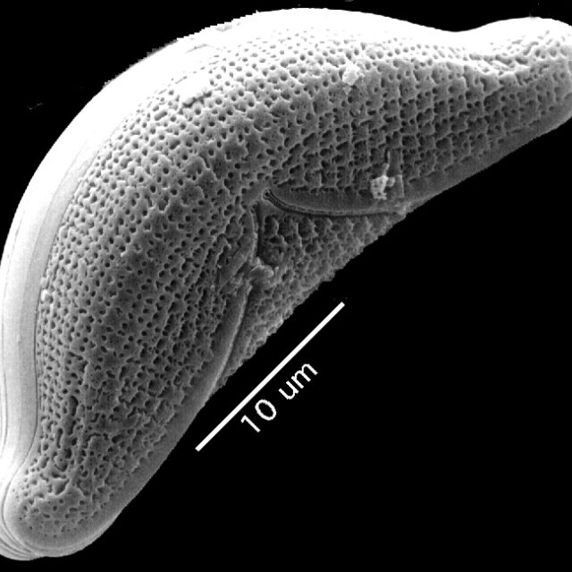 Epithemia sorex SEM1