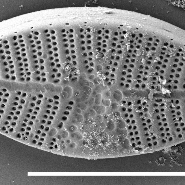 Planothidium californicum SEM3