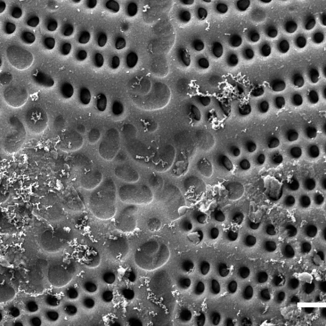 Planothidium californicum SEM4