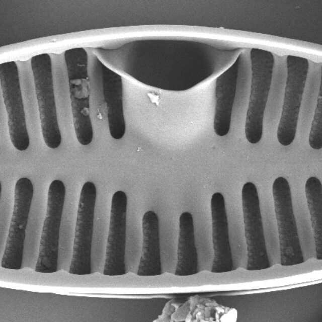 Planothidium Sheathii Sem03