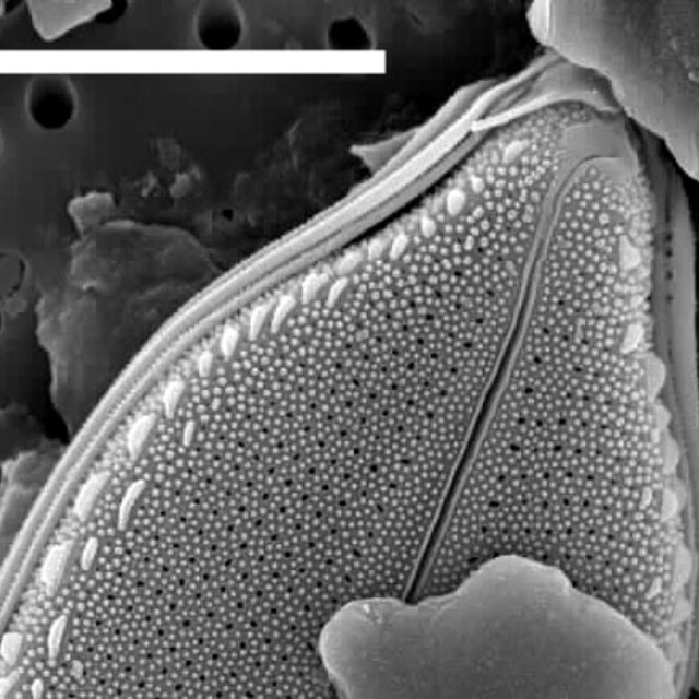 Playaensis circumfimbria SEM2