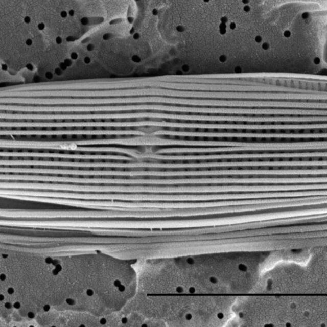 Proschkinia Browderiana Sem1