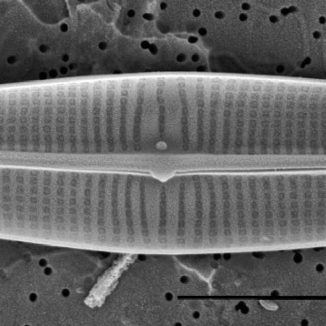 Proschkinia Browderiana Sem2