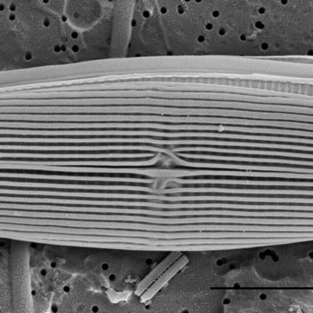 Proschkinia Browderiana Sem3