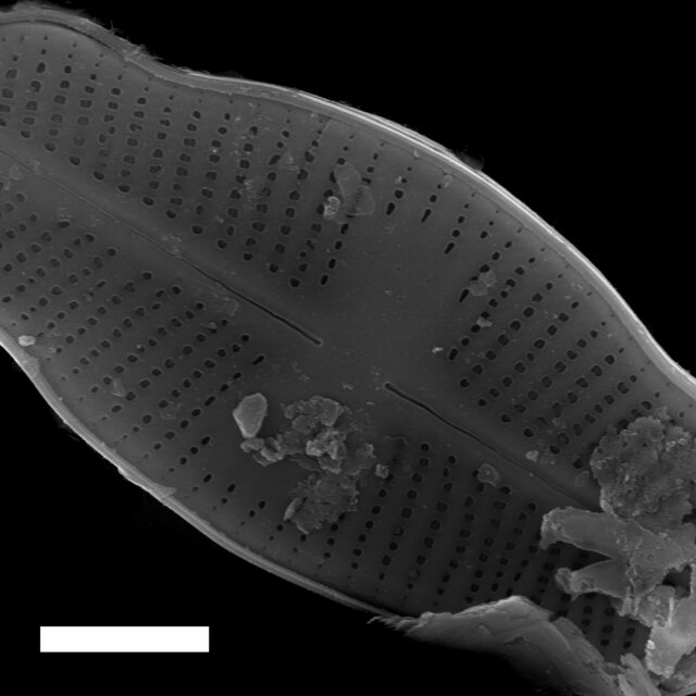 Psammothidium Ventrale gs007701 03 SEM