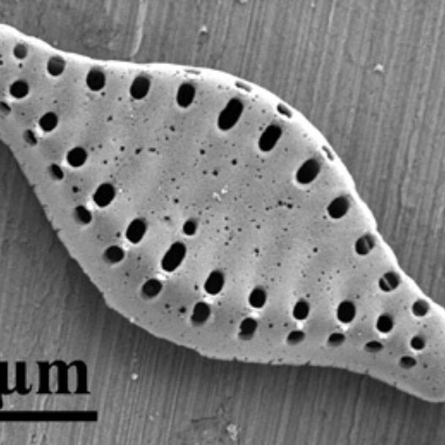 Pseudostaurosira microstriata SEM2