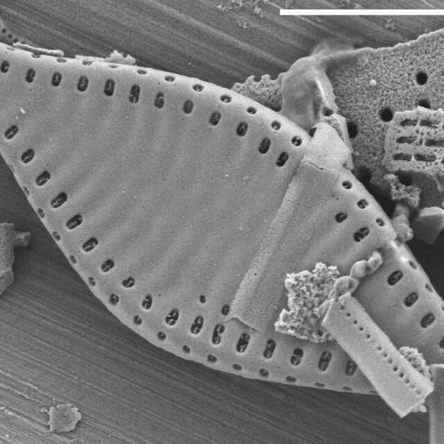 Pseudostaurosira parasitica SEM1