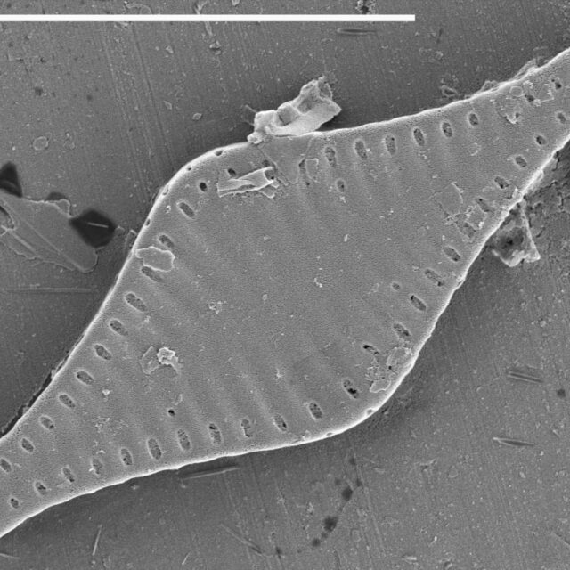 Pseudostaurosira parasitica SEM4