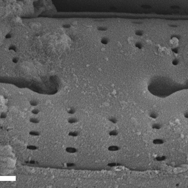 Rhoicosphenia californica SEM1