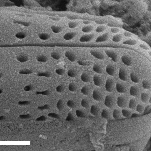 Rhoicosphenia californica SEM3