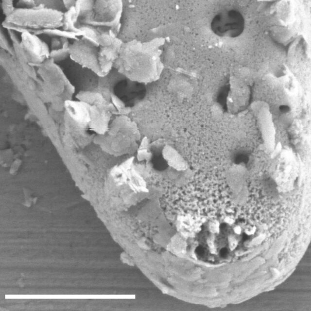 Pseudostaurosira elliptica SEM1