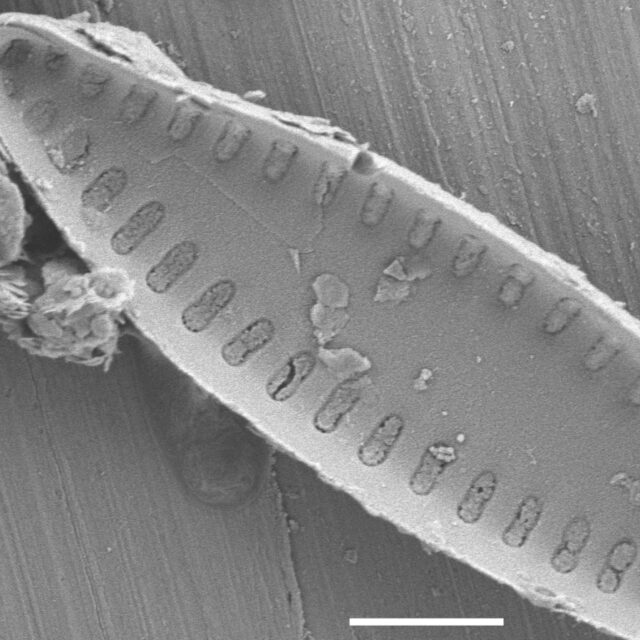 Pseudostaurosira elliptica SEM3