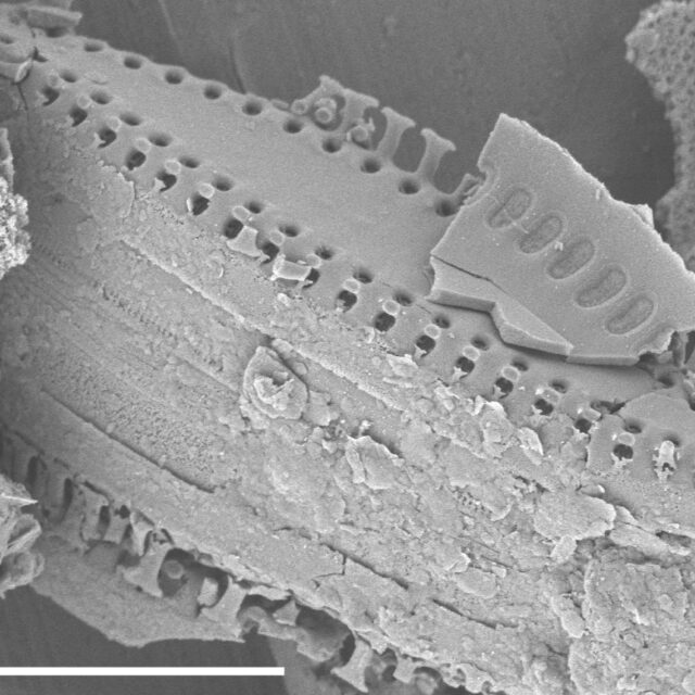 Pseudostaurosira elliptica SEM4