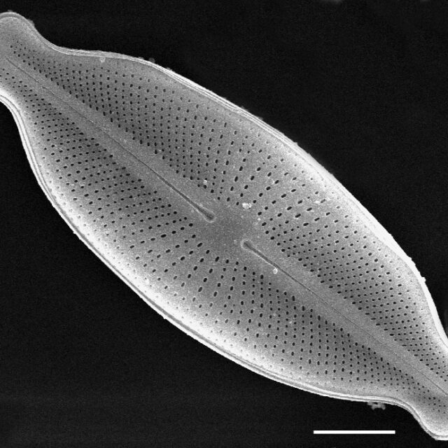 Cosmioneis hawaiiensis SEM2