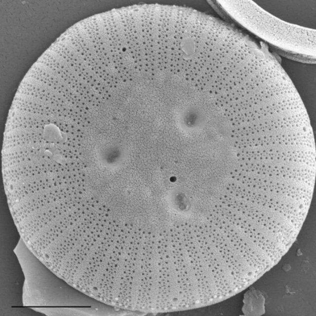 Lindavia ocellata SEM1