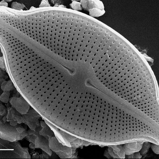 Cosmioneis citriformis SEM1