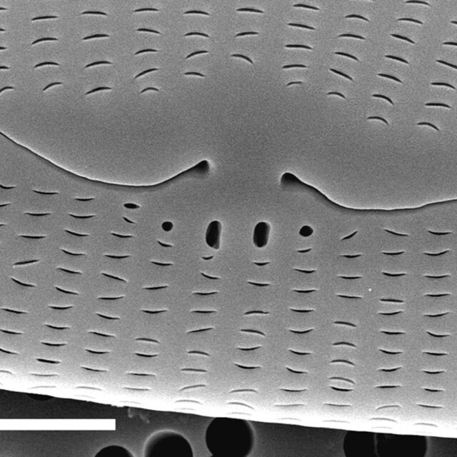 Sem External Middle5Microns