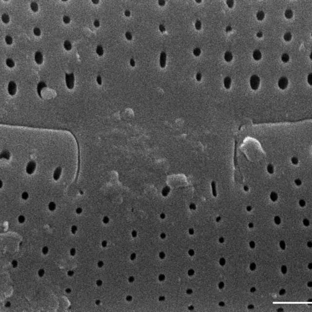 Frustulia creuzburgensis SEM1