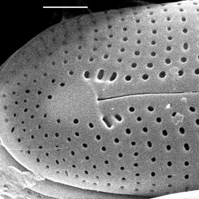 Frustulia creuzburgensis SEM3