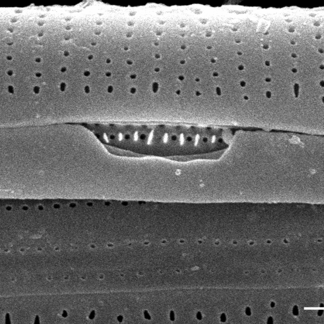 Frustulia creuzburgensis SEM4