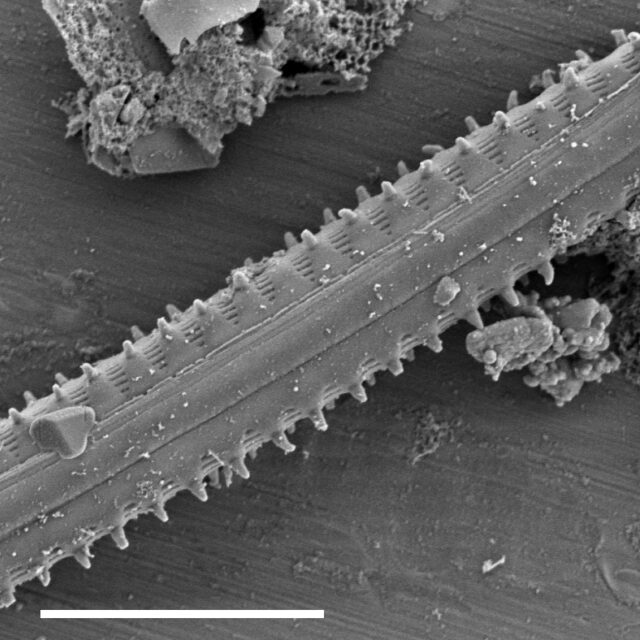 Staurosirella berolinensis SEM1