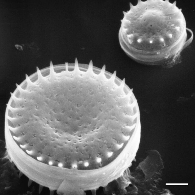 Stephanodiscus minutulus SEM3