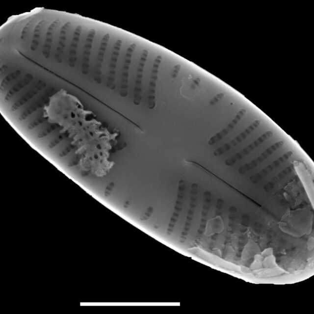 Sellaphora Atomoides Sem2