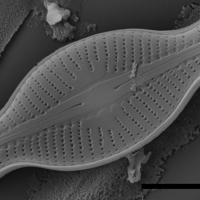 Sellaphora schadei SEM 1