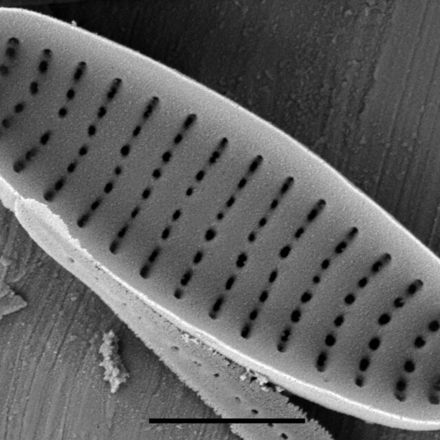 Stauroforma exiguiformis SEM3