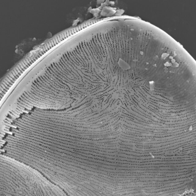 Surirella Undulata Sem 1