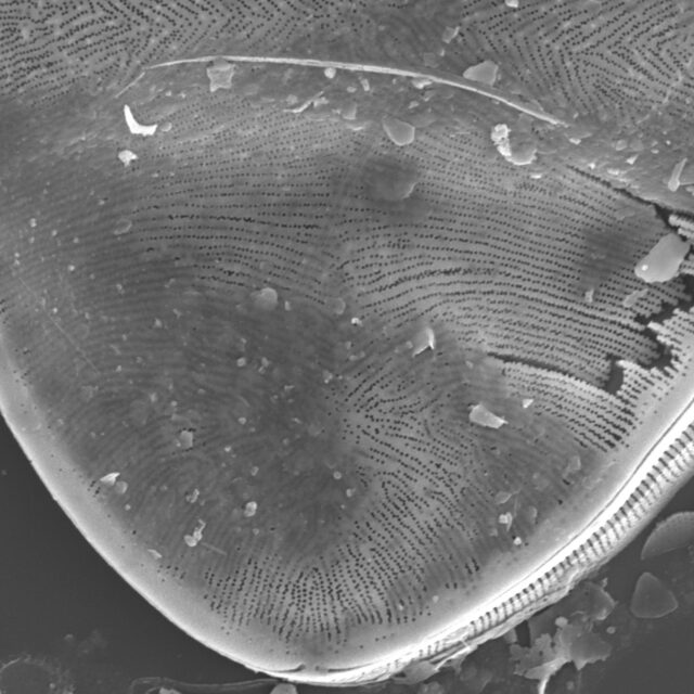 Surirella Undulata Sem 2