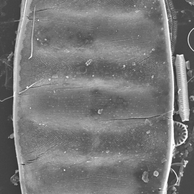 Surirella Undulata Sem 3