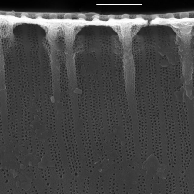 Surirella suecica SEM1