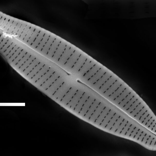 Achnanthidium gracillimum SEM4