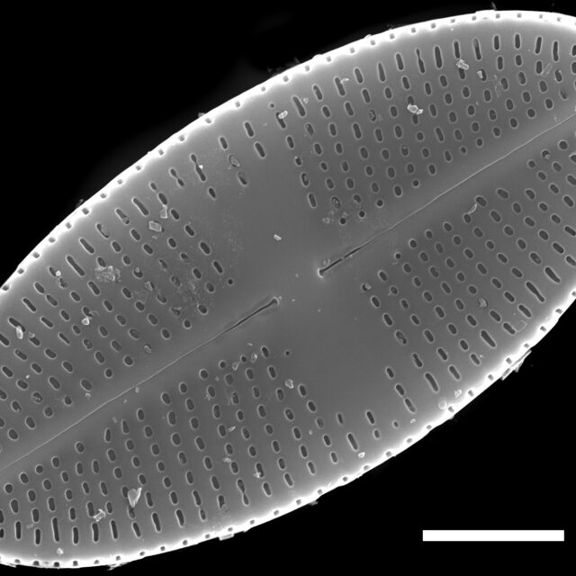 Psammothidium nivale SEM1