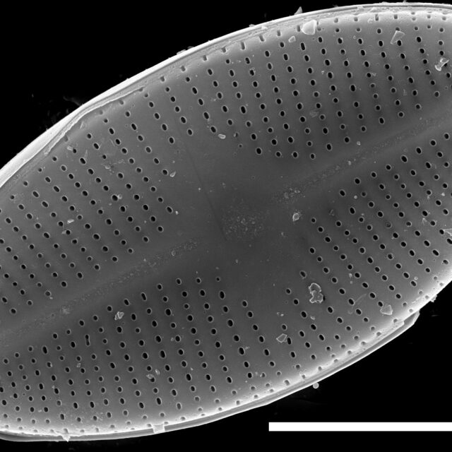 Psammothidium lacustre SEM2