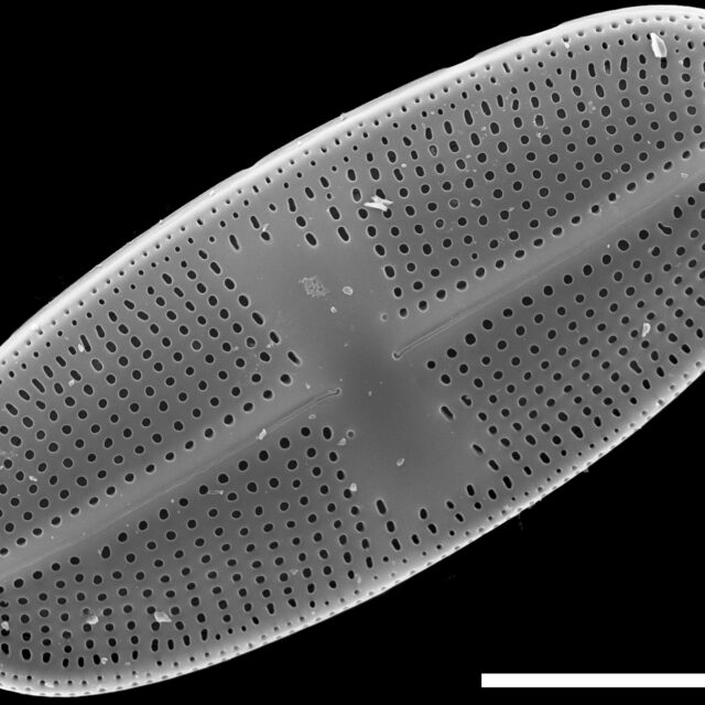 Psammothidium alpinum SEM2