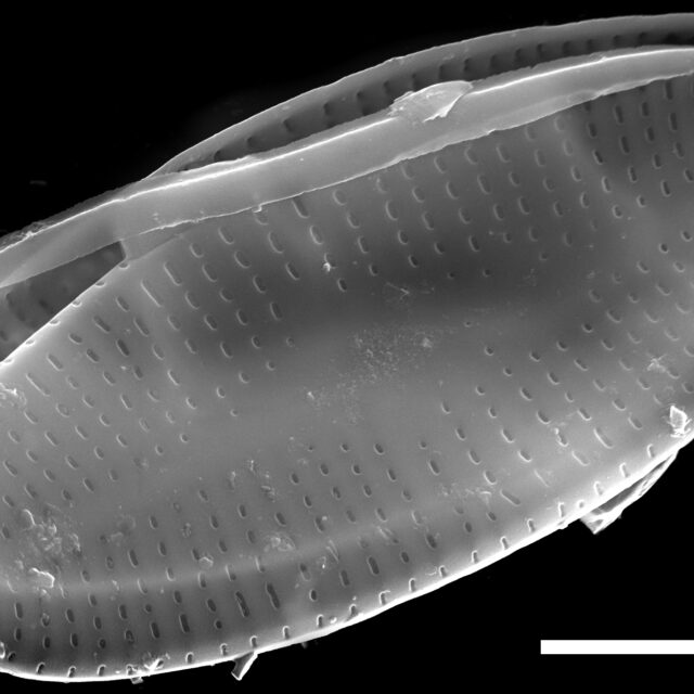 Psammothidium nivale SEM2