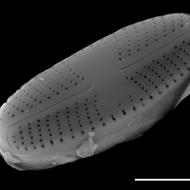 Sellaphora atomoides SEM1