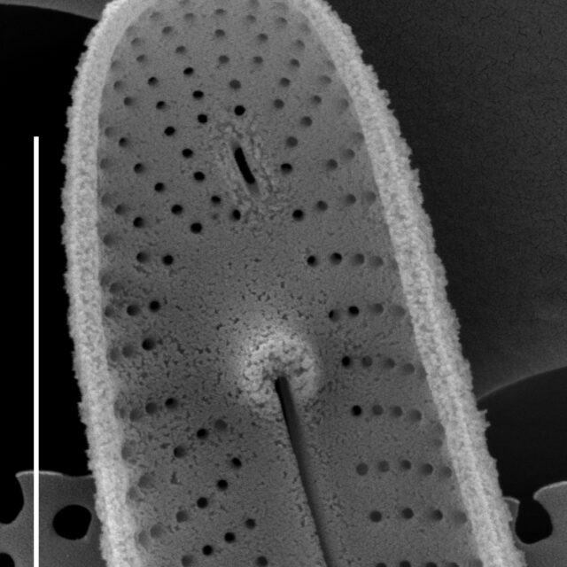 Peronia fibula SEM2