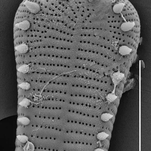 Peronia fibula SEM3